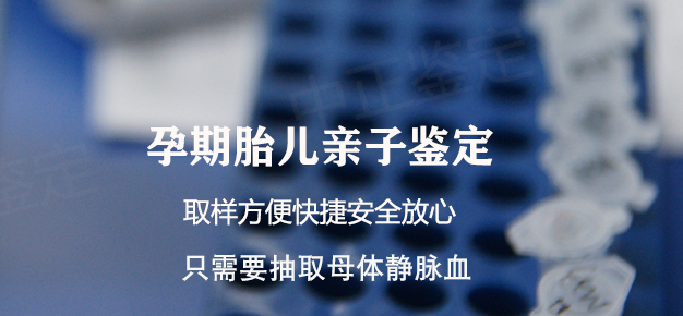 昆明怀孕亲子鉴定机构查询,昆明孕期亲子鉴定哪里做的准