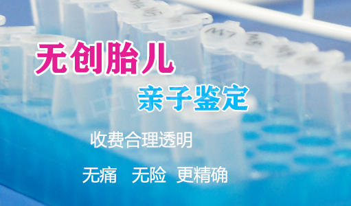 昆明怎么做胎儿亲子鉴定,在昆明做孕期亲子鉴定需要多少钱